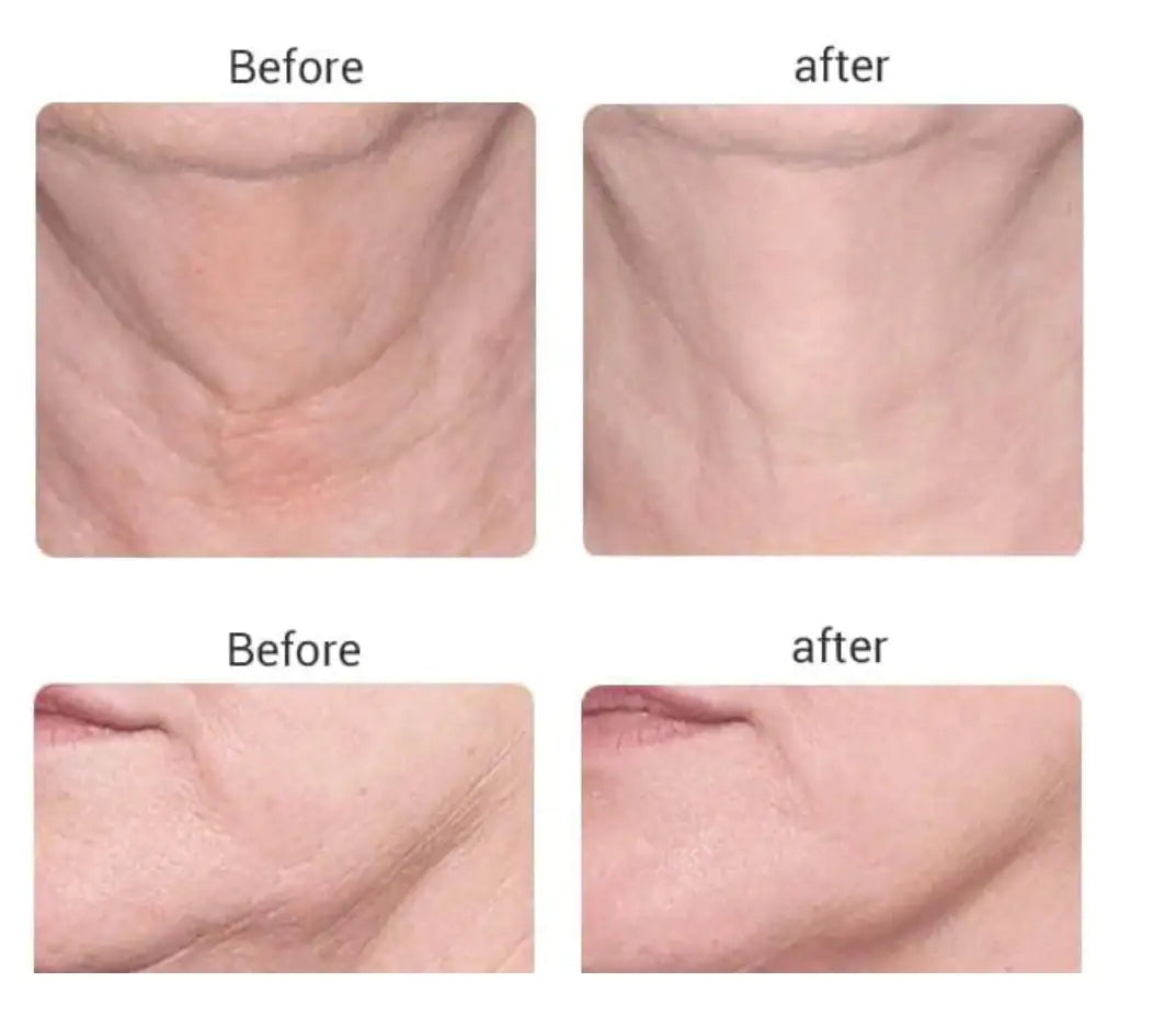 PRO Microcurrent Facial Toning Massager