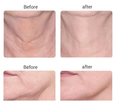 PRO Microcurrent Facial Toning Massager