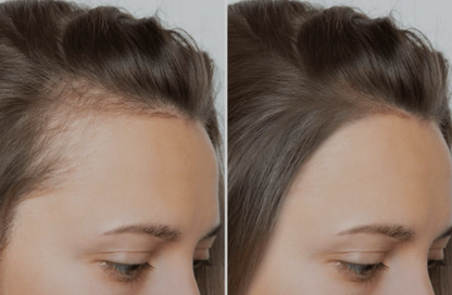 Advanced Infrared Red Light Hair Growth Cap