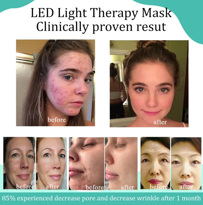 Professional Grade LED Skin Rejuvenation Mask