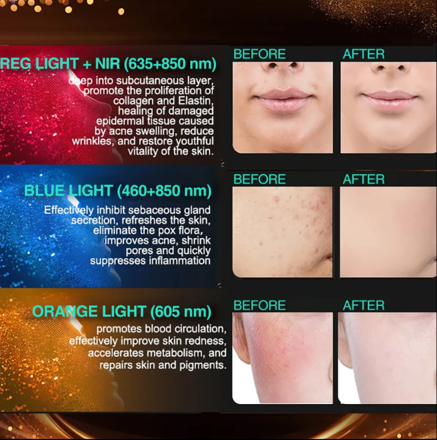 Professional Grade LED Skin Rejuvenation Mask