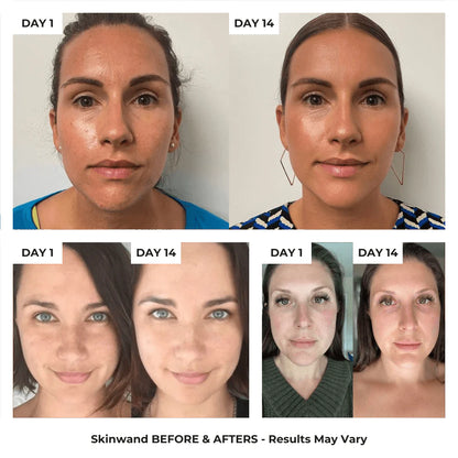 4 in 1 Skincare Wand with Red Light Therapy