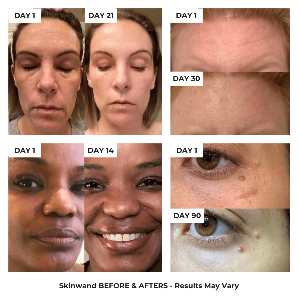 4 in 1 Skincare Wand with Red Light Therapy