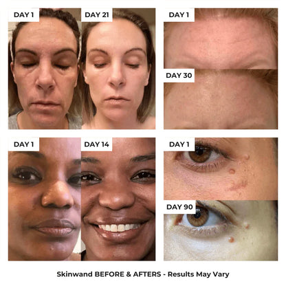 4 in 1 Skincare Wand with Red Light Therapy